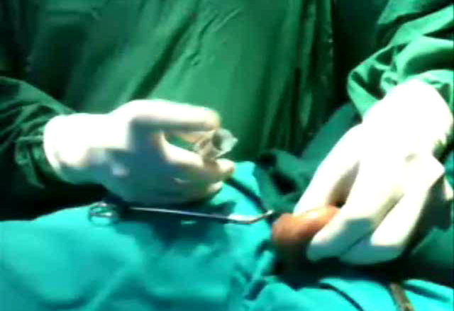 Surgical Sperm Recovery